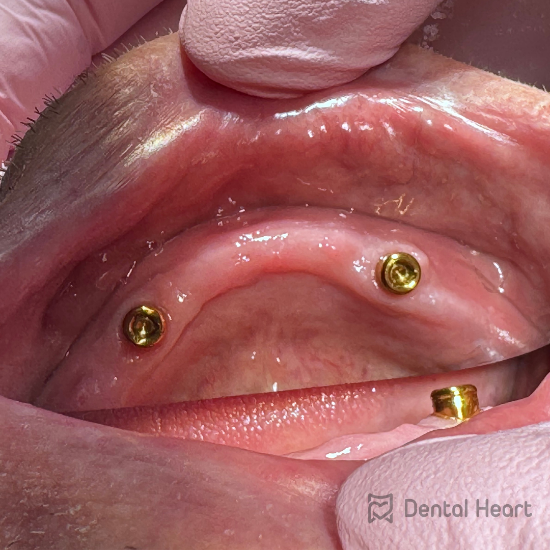 Dental Heart