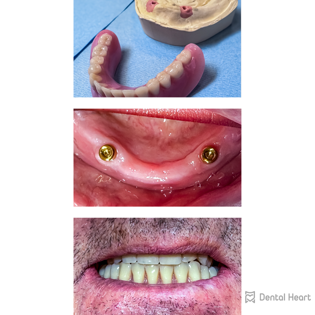 Dental Heart
