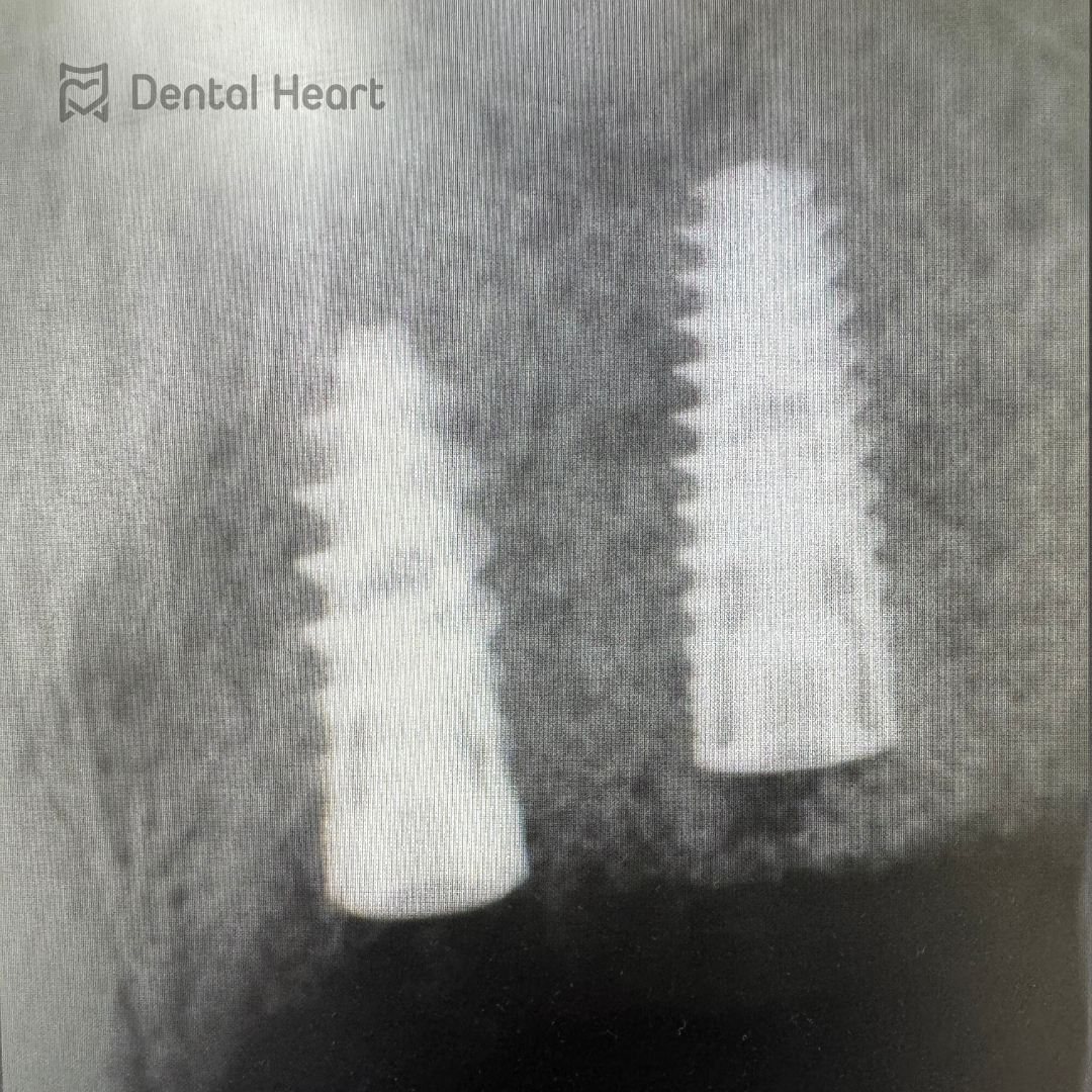 Dental Heart
