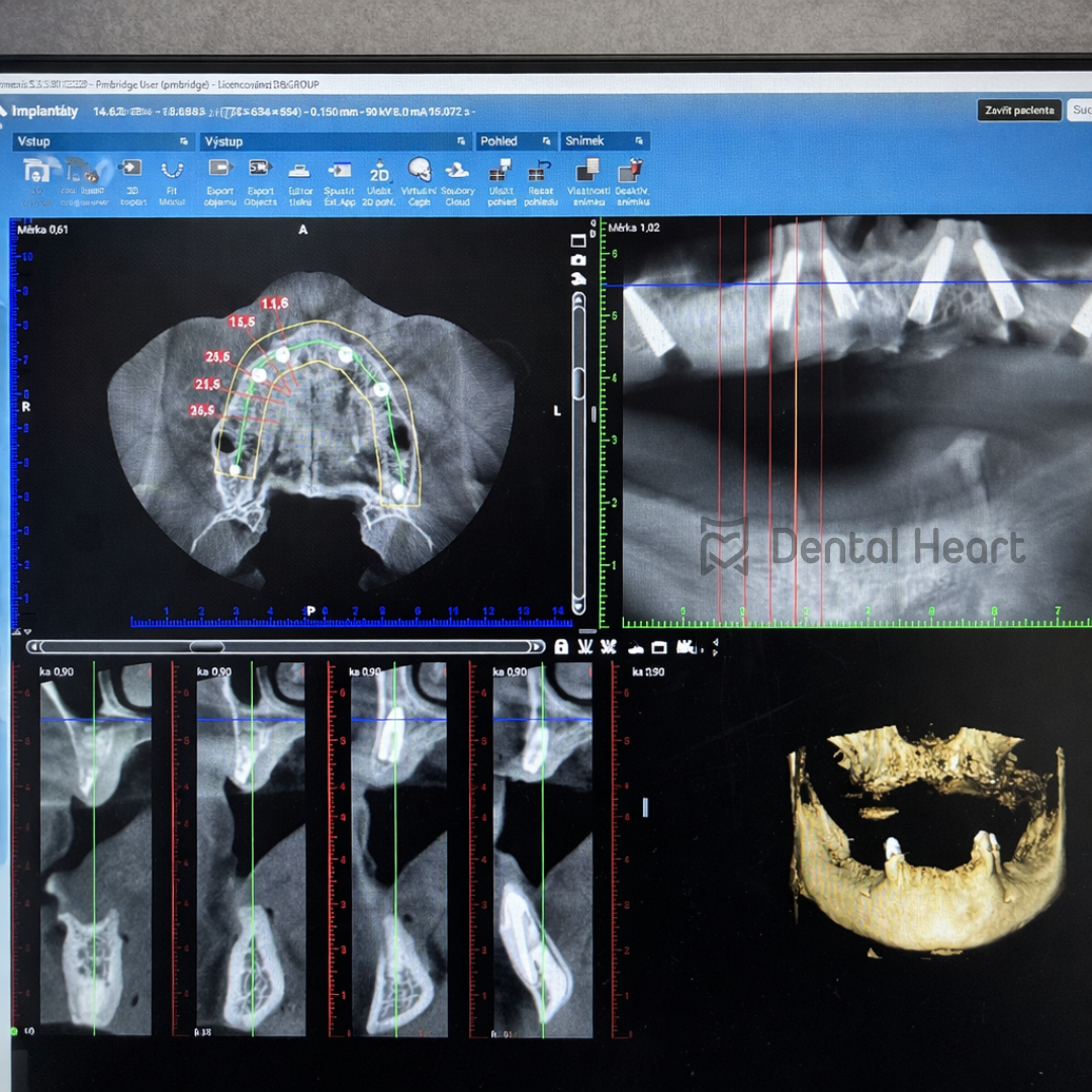Dental Heart