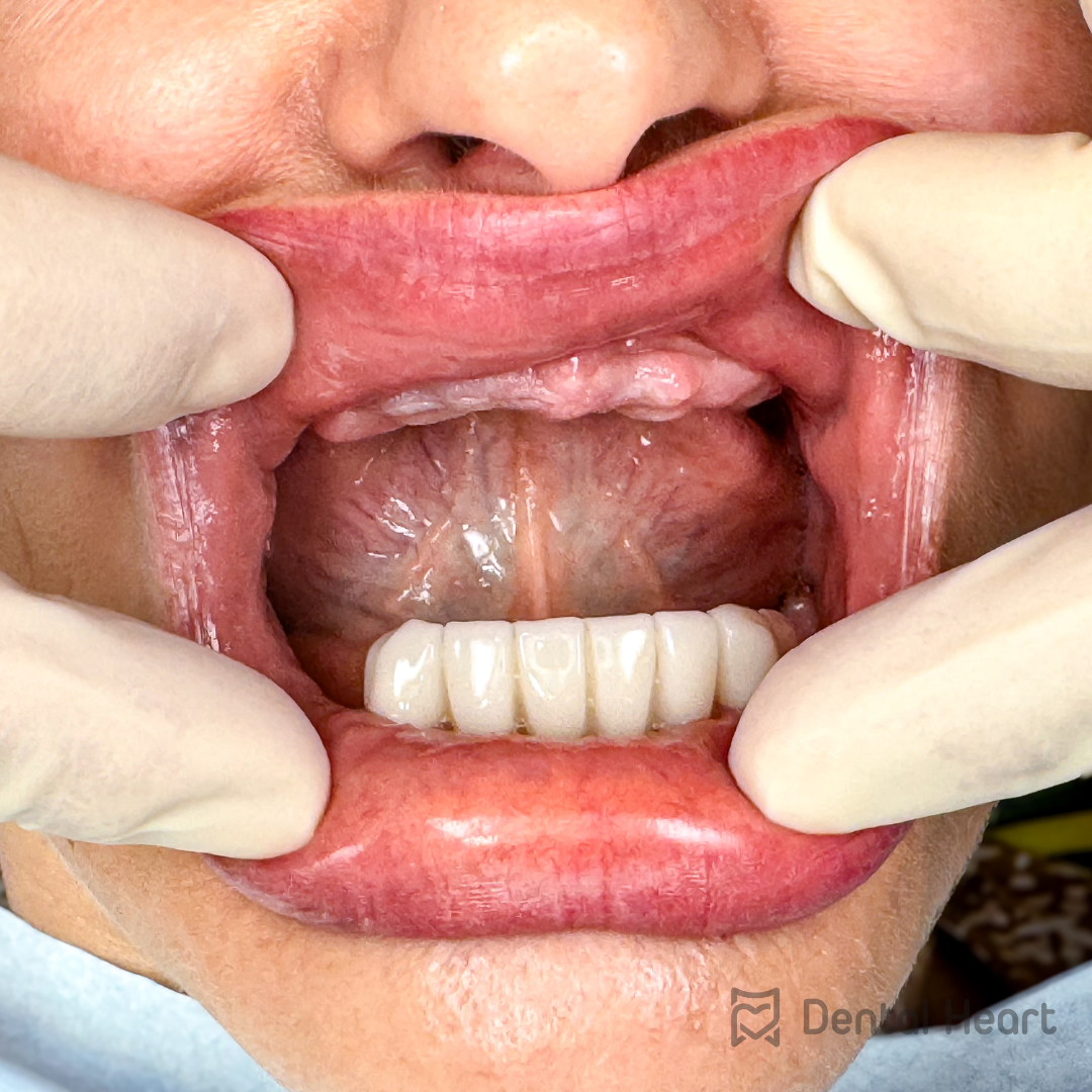 Dental Heart
